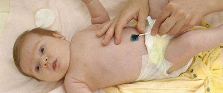 Що робити якщо погано гоїться пупок у новонародженого?