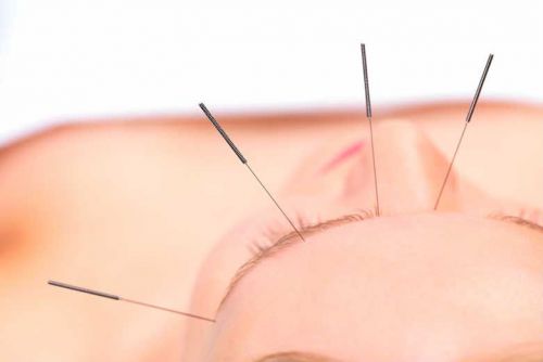 Що можна пити від головного при грудному вигодовуванні Що можна пити від головного при грудному вигодовуванні